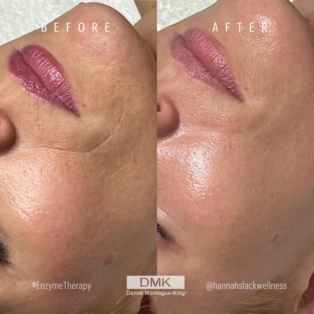 @hannahslackwellness-1x-Enzyme-Therapy-BA-Age-Management-Texture